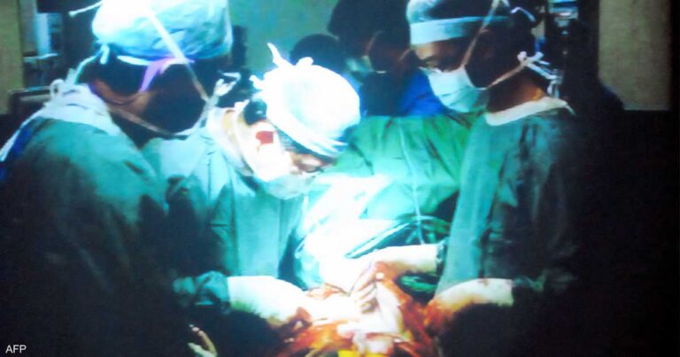 الصينيون يزرعون كبد خنزير في جسم إنسان الصينيون يزرعون كبد خنزير في جسم إنسان