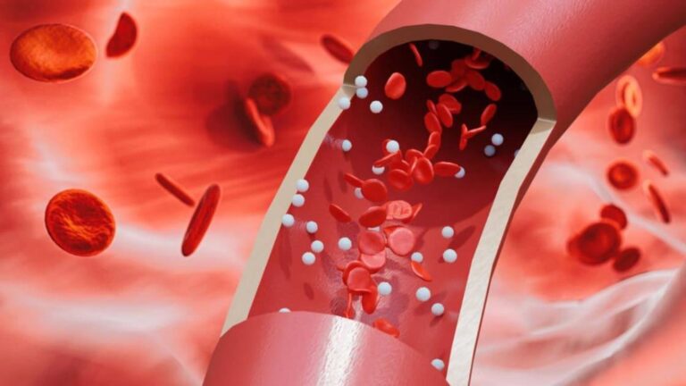 الجسيمات البلاستيكية النانو تهدد شرايين الرقبة الجسيمات البلاستيكية النانو تهدد شرايين الرقبة