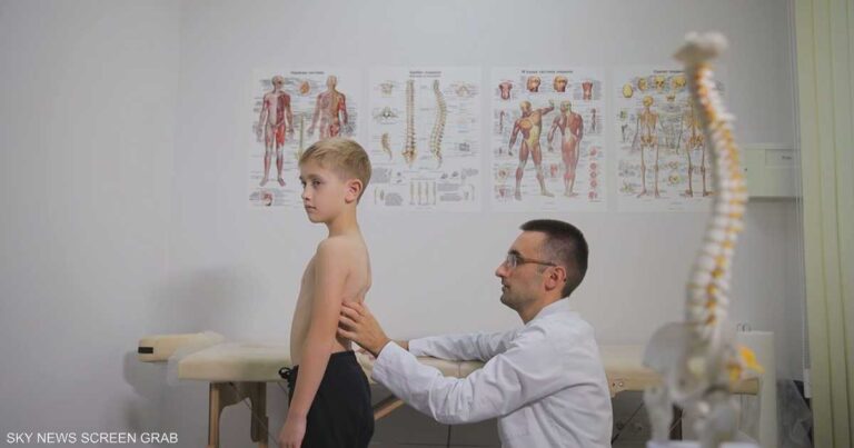 انحناء العمود الفقري.. أسبابه وطرق اكتشافه وعلاجه