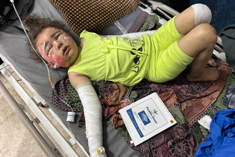 إصابات الحروق القاتلة بلا علاج في غزة | سياسة