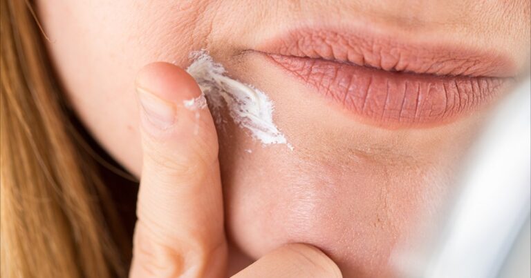 واحدة من كل أربع نساء تقول إنها تعاني من أعراض الأكزيما بعد انقطاع الطمث | صحة