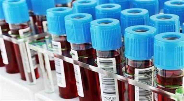 اليابان تختبر دما اصطناعيا قد ينقذ ملايين الأرواح » وكالة بغداد اليوم الاخبارية اليابان تختبر دما اصطناعيا قد ينقذ ملايين الأرواح » وكالة بغداد اليوم الاخبارية