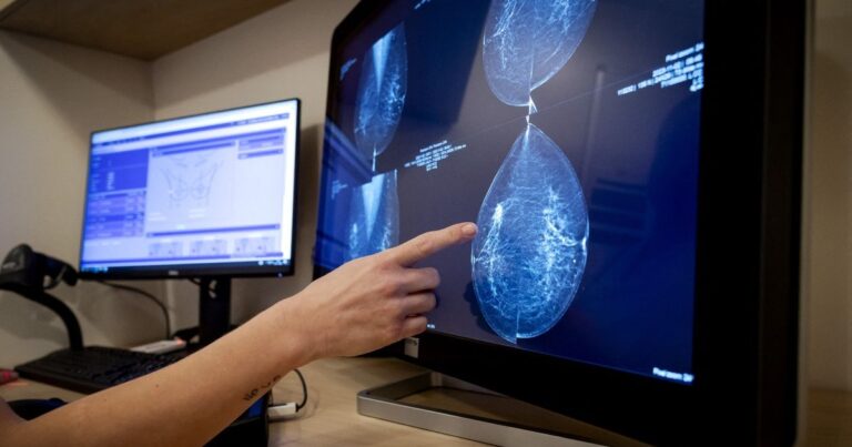 دراسة: الإستروجين آمن لكبيرات السن المتعافيات من سرطان الثدي العلاج الهرموني لسرطان الثدي يقلل خطر الإصابة بالخرف وألزهايمر