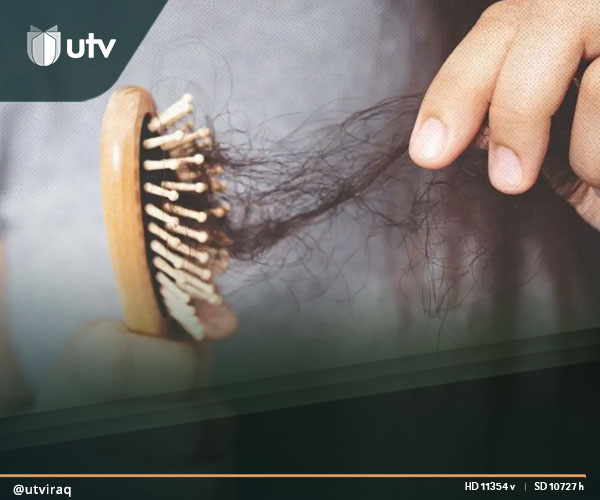 UTV العراق – بينها تساقط الشعر.. أعراض خفية لنقص الزنك عند النساء UTV العراق - بينها تساقط الشعر.. أعراض خفية لنقص الزنك عند النساء