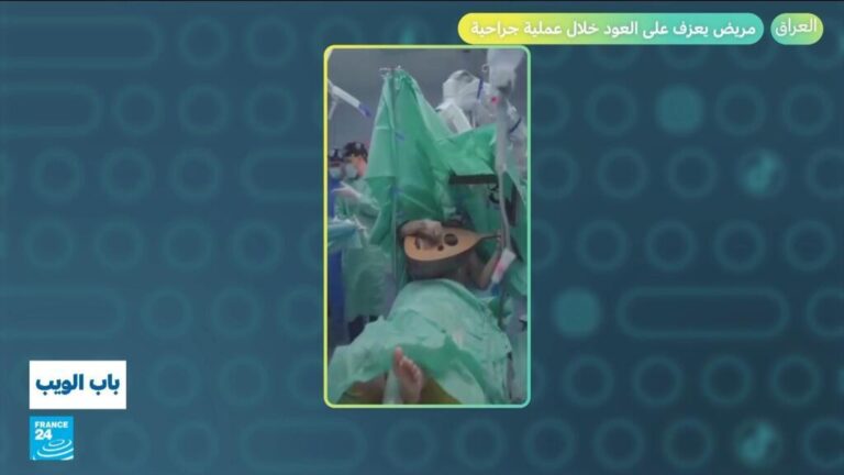 العراق.. مريض يعزف على العود خلال عملية جراحية! العراق.. مريض يعزف على العود خلال عملية جراحية!