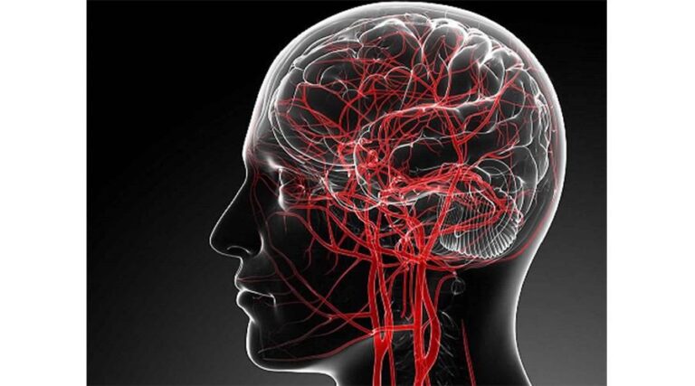 مكافحة الزهايمر بتدفق الدم إلى الدماغ مكافحة الزهايمر بتدفق الدم إلى الدماغ