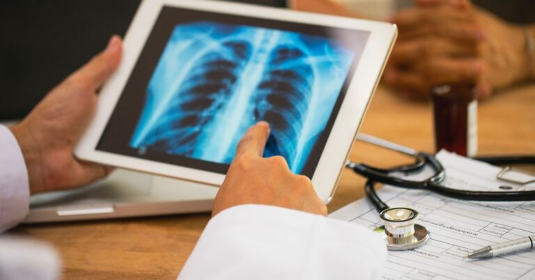 أداة إلكترونية تفاعلية قد تساعد في خفض وفيات سرطان الرئة نهج مبتكر في علاج سرطان الرئة بالإشعاع يقلل خطر إصابة القلب