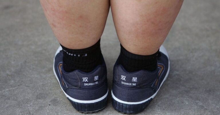 دراسة: جينات الأم قد تؤثر على وزن الطفل أكثر من الأب دراسة تحذر من فشل عالمي في مواجهة السمنة بين الأطفال والمراهقين