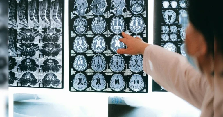 الهند.. 19 حالة وفاة بسبب الأميبا آكلة الدماغ والسلطات تتأهب