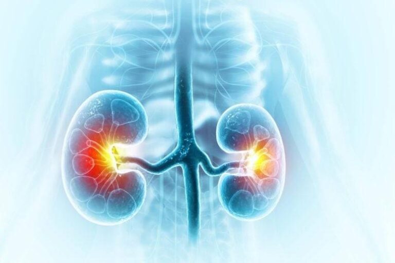 دواء لعلاج الإمساك يحسن وظائف الكلى