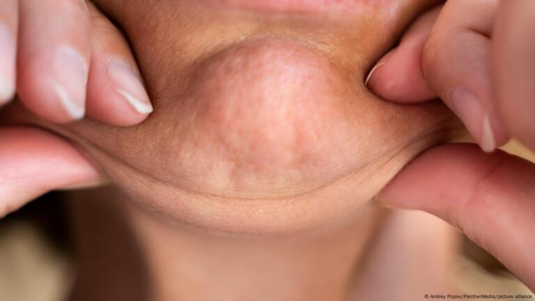 محيط رقبتك مؤشر على أمراض خطيرة قد لا تتوقعها! – DW – 2025/9/29