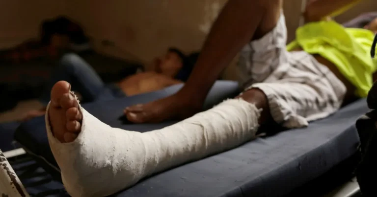 "مسدس غراء".. باحثون يطورون تقنية لإصلاح العظام المكسورة