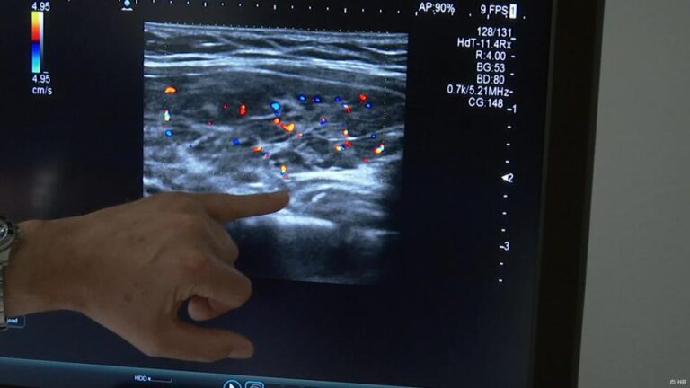 هاشيموتو- كيف نحمي الغدة الدرقية؟ – DW – 2025/9/19 هاشيموتو- كيف نحمي الغدة الدرقية؟ – DW – 2025/9/19