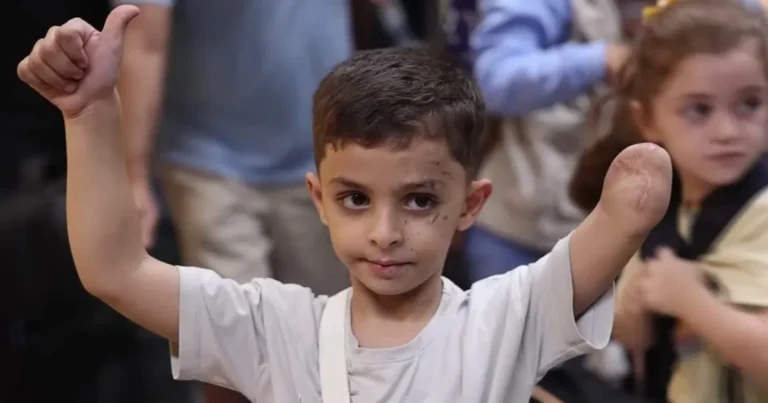 هنا غزة.. شهادت حيّة بين "بتر اضطراري" و"إنقاذ مؤجل" (صور)