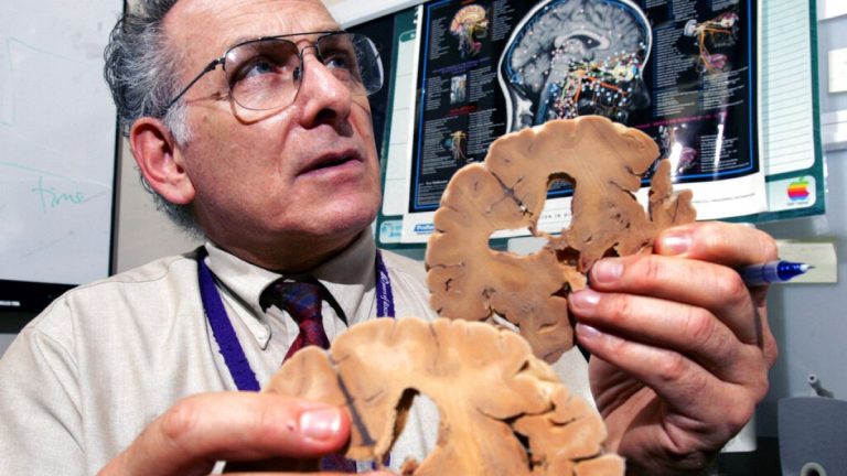 الليثيوم ودوره الغامض في الدماغ.. هل يمكن أن يقي من ألزهايمر؟