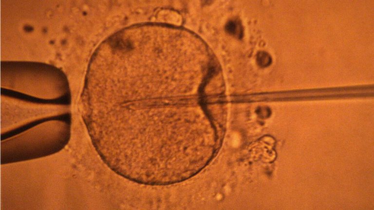 دراسة جديدة تكشف أن عمر الأب يؤثر على نتائج الحمل دراسة جديدة تكشف أن عمر الأب يؤثر على نتائج الحمل