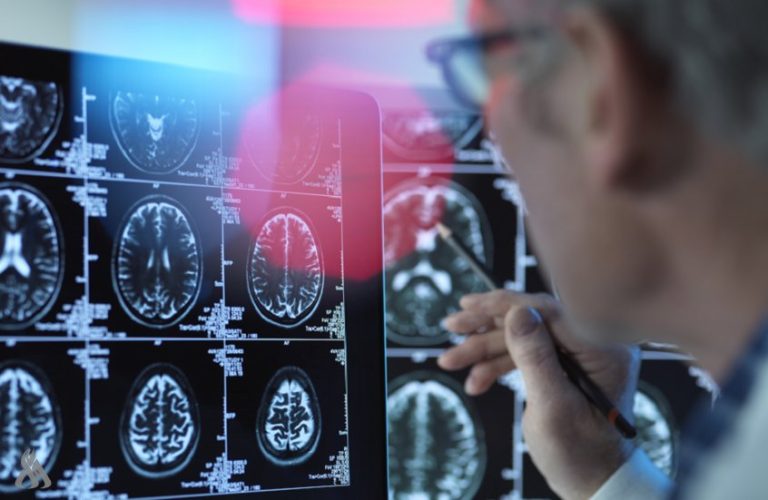 طريقة ثورية لرصد علامات ألزهايمر قبل بدايته » وكالة الانباء العراقية (واع) طريقة ثورية لرصد علامات ألزهايمر قبل بدايته