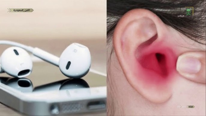 قد يهدّد سمعك.. احذر هذا النوع من سماعات الأذن » وكالة بغداد اليوم الاخبارية قد يهدّد سمعك.. احذر هذا النوع من سماعات الأذن » وكالة بغداد اليوم الاخبارية