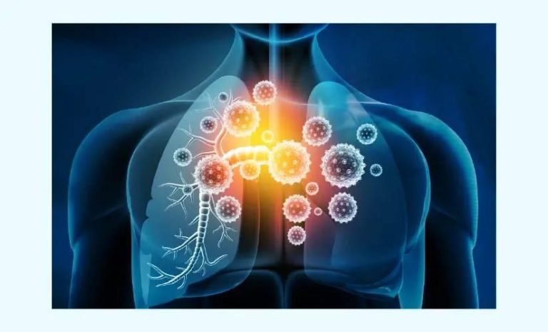 العدوى الفيروسية تزيد أخطار الإصابة بأمراض القلب العدوى الفيروسية تزيد أخطار الإصابة بأمراض القلب