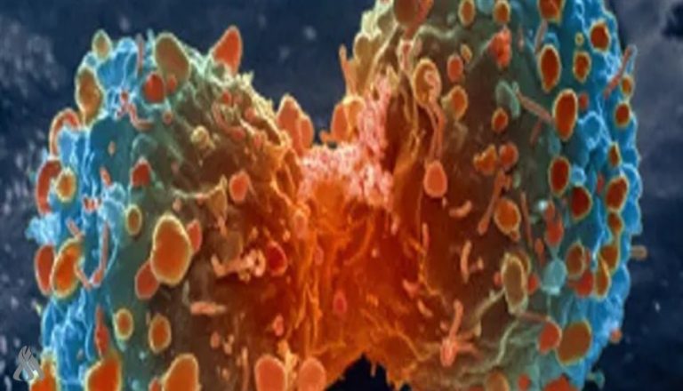 الكشف عن آلية جديدة تحفز المناعة لعلاج سرطان البنكرياس » وكالة الانباء العراقية (واع) الكشف عن آلية جديدة تحفز المناعة لعلاج سرطان البنكرياس