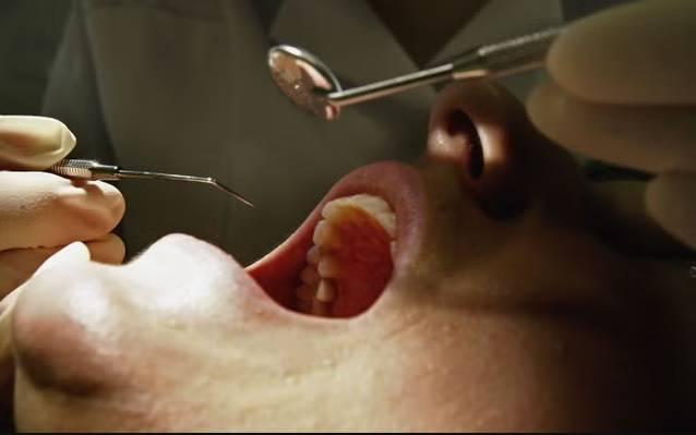 سوء نظافة الأسنان ينتهي بسكتة دماغية سوء نظافة الأسنان ينتهي بسكتة دماغية