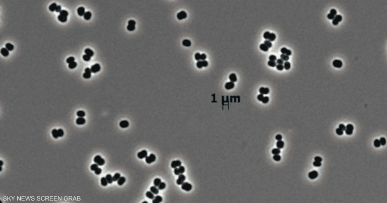 حتى في بيئة معقمة.. اكتشاف بكتيريا قادرة على التظاهر بالموت حتى في بيئة معقمة.. اكتشاف بكتيريا قادرة على التظاهر بالموت