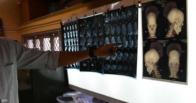 دراسات تكشف علاقة “مقلقة” بين الاكتئاب والصرع دراسات تكشف علاقة "مقلقة" بين الاكتئاب والصرع