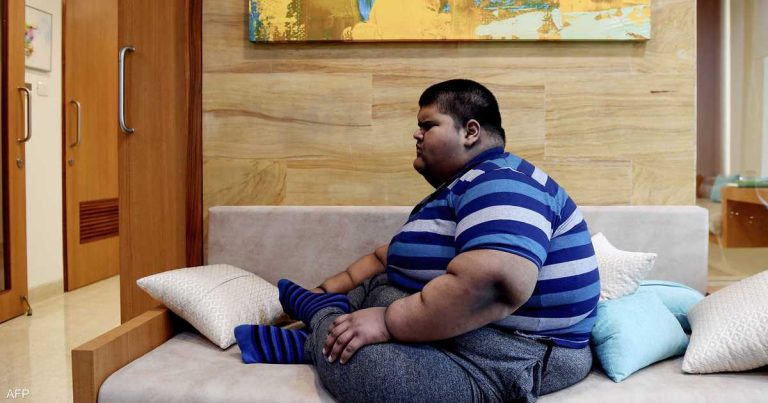 السمنة تزيد خطر الإصابة بـ 61 مرضا مهددا للحياة