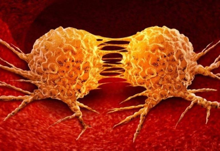 باحثون: تسارع معدلات وفاة مرضى السرطان خلال الفترة الأولى من الجائحة