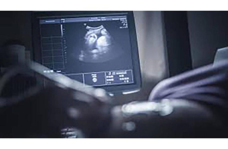 ذكاء اصطناعي يكشف مضاعفات الحمل الخطرة ذكاء اصطناعي يكشف مضاعفات الحمل الخطرة