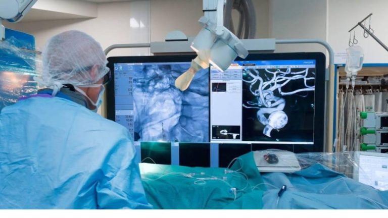 نجاح أول روبوت لتصوير أوعية الدماغ