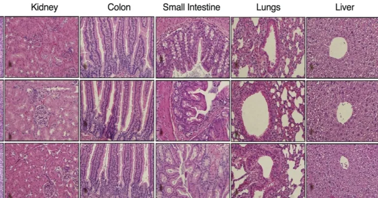 باحثون يطورون "دواء واحد" يقضي على 4 أنواع من السرطان