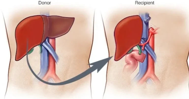 تجربة بشرية تدريب جهاز المناعة الكبد المزروع أدوية تثبيط