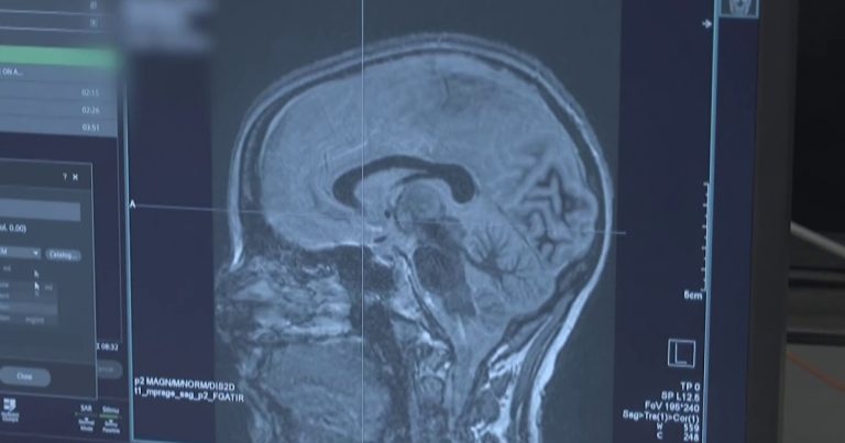 توفر التكنولوجيا الجديدة الأمل لمرضى باركنسون توفر التكنولوجيا الجديدة الأمل لمرضى باركنسون