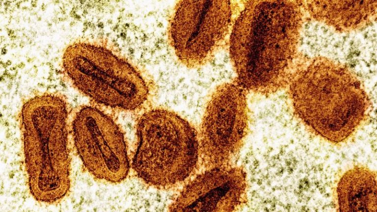عالمان متهمان بإحضار فيروس mpox المعطل إلى الولايات المتحدة والكذب على السلطات